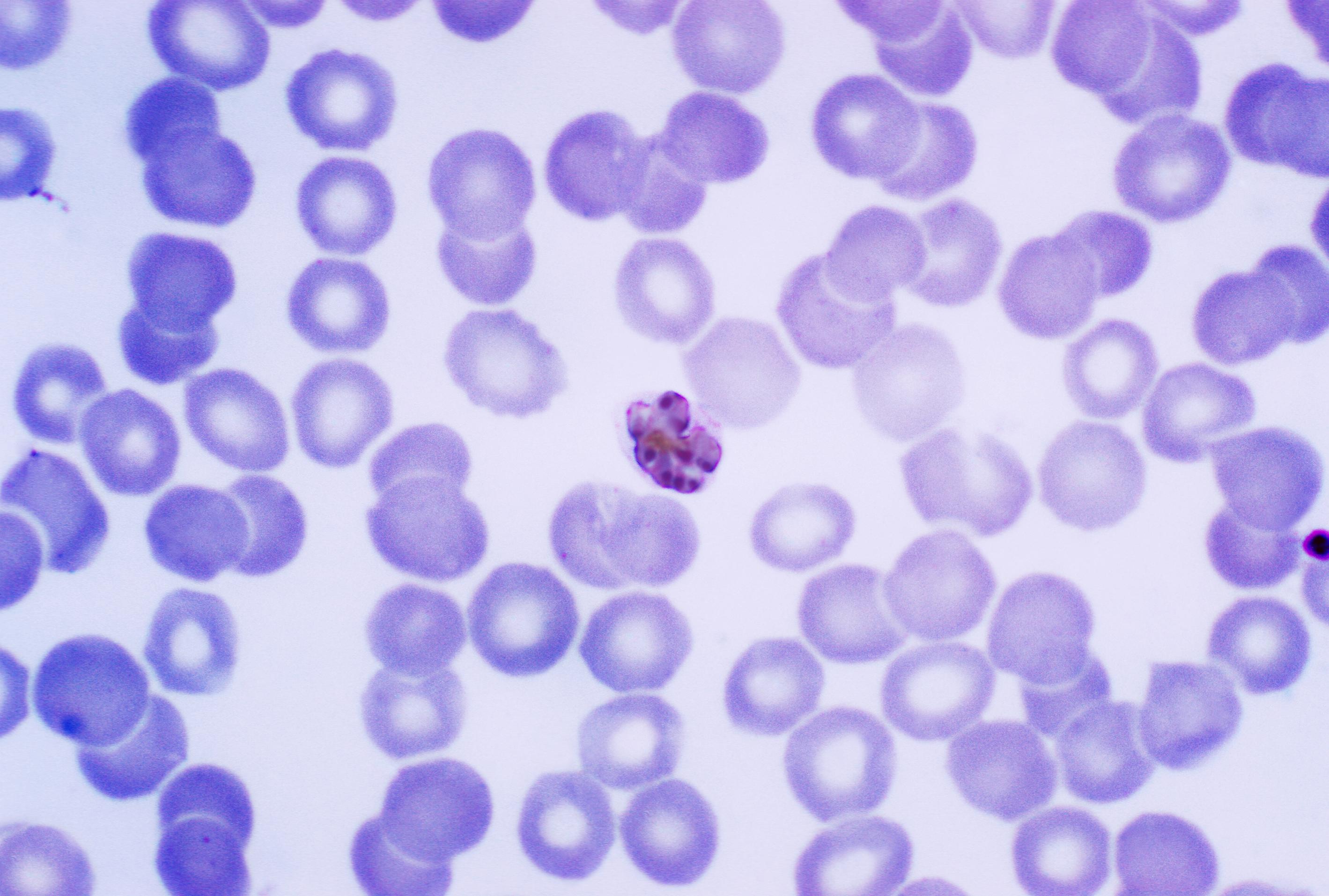 Volwassen malaria parasiet tussen de rode bloedlichaampjes
